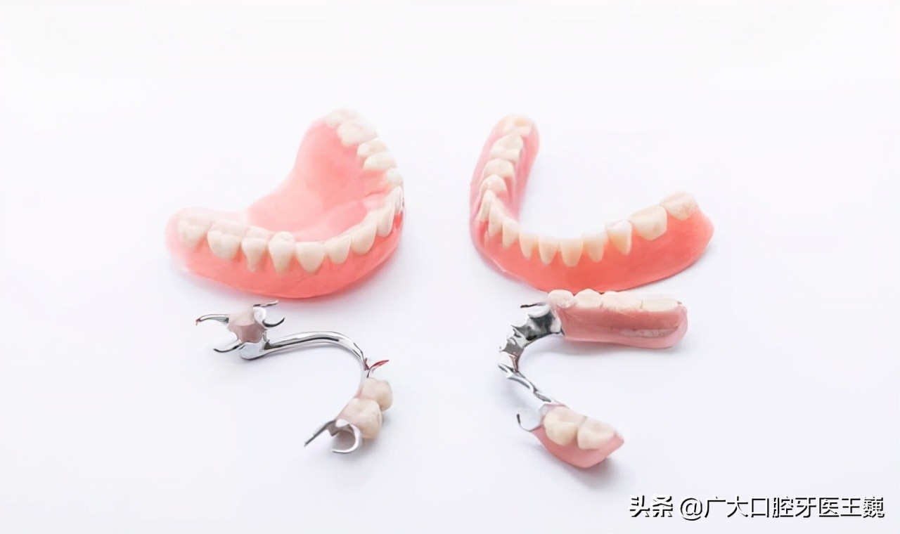 老年人缺牙怎样解决最好,中老年缺牙怎么办