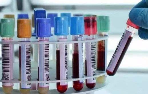 做胃镜要抽血查梅毒和艾滋病吗,做胃镜为什么要做艾滋病梅毒检查