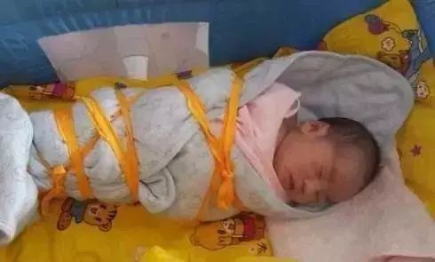 刚出生的小孩腿怎么伸不直,新生儿需要把腿捆上吗