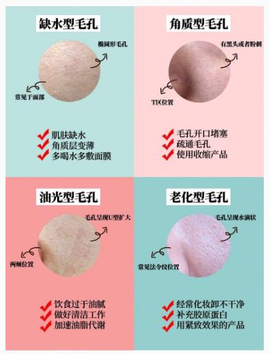 毛孔粗大收缩毛孔最有效方法,收缩毛孔的方法日常如何收缩毛孔