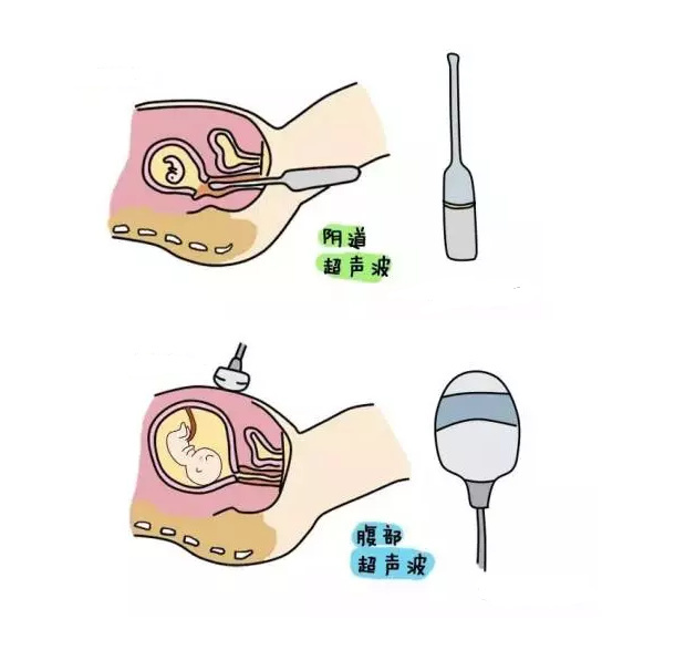 想怀孕需要做卵泡监测吗,想怀孕需要做体检吗