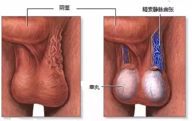 “dan疼”到底有多痛？你了解吗？