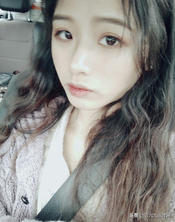 龅牙矫正成功的图片对比,2周岁龅牙可以矫正吗