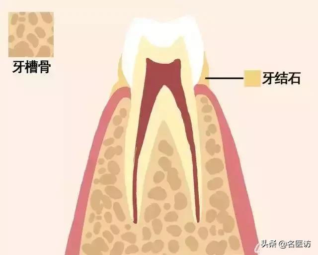 牙齿摔松动怎么办,牙齿松动恢复秘方