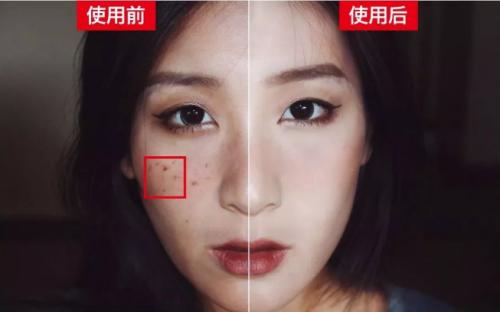 解决斑点问题，浪漫香榭丽我看行