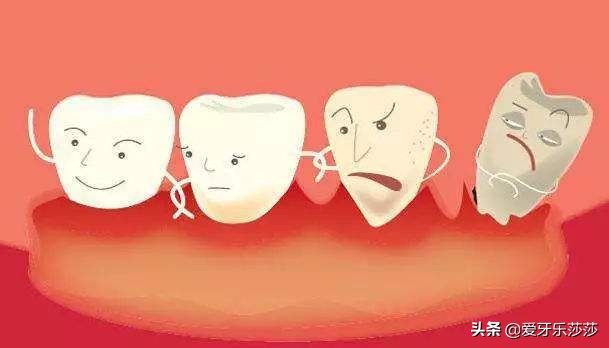 牙齿矫正后黑三角严重怎么办,儿童牙齿矫正会出现黑三角吗