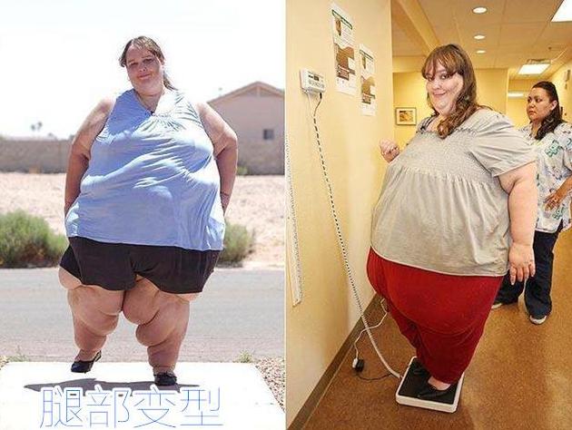 俩女人,一个身材臃肿,一个身材窈窕,生育时的差距一目了然