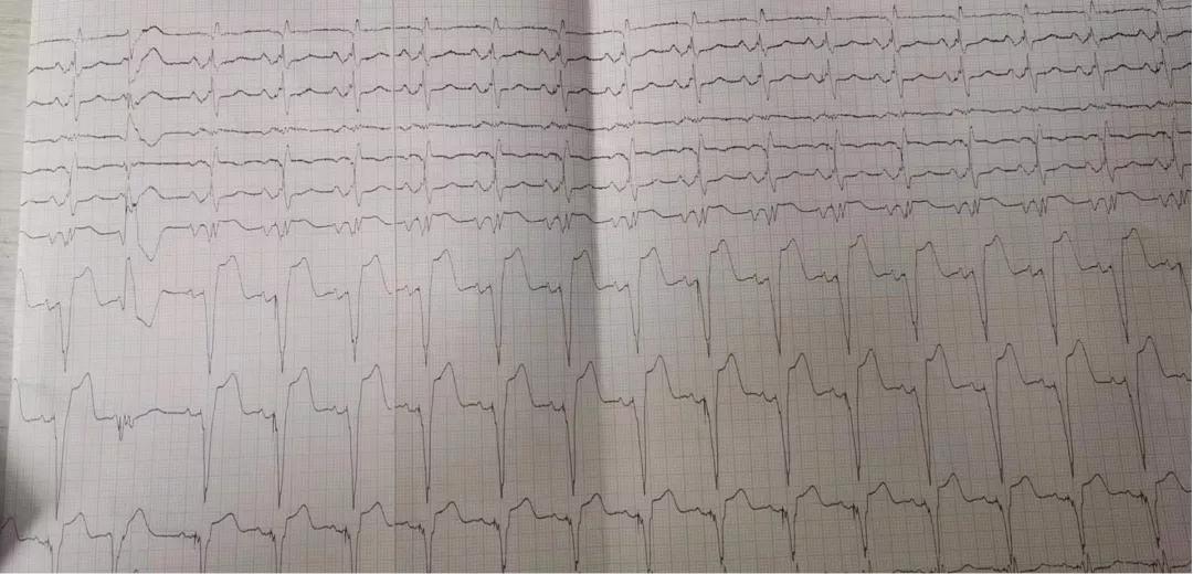 患者的治疗方案?患者的选择或是医生的选择,如何选择最优解?