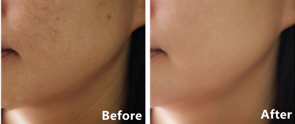 老字号祛斑面霜,一瓶祛斑的面霜