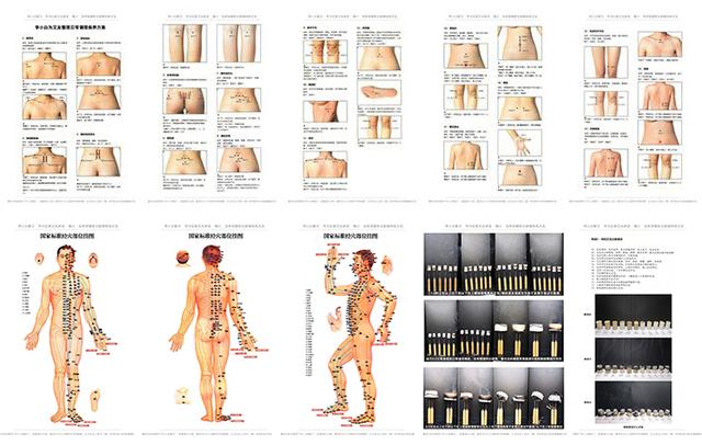 三九灸与三伏灸哪个效果好,三九灸和三伏灸有何区别
