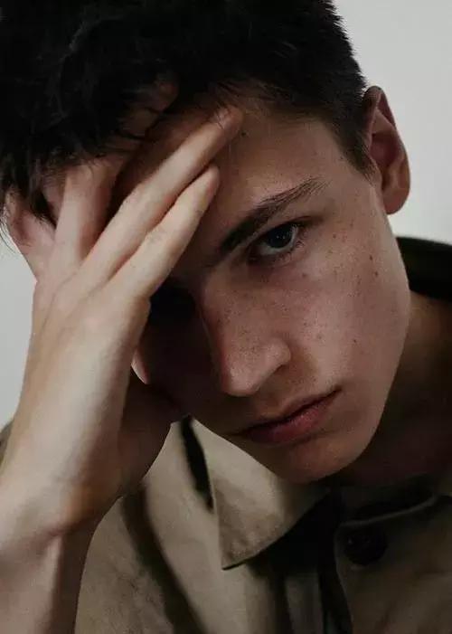 暗疮没有脓头怎么办,暗疮是不是不应该挤掉