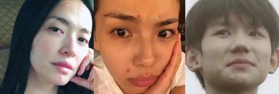 美摩仕祛痘膏效果好吗,美摩仕祛痘效果好吗