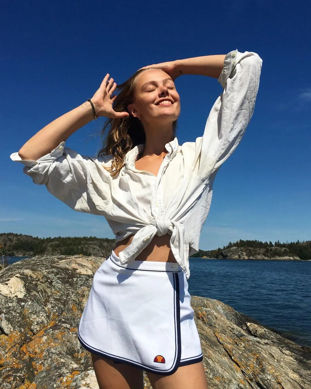 为什么要精灵耳整形,精灵耳招风耳整形