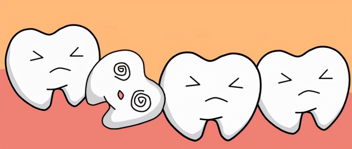 如何判断牙齿拥挤程度,牙齿拥挤对脸型的影响