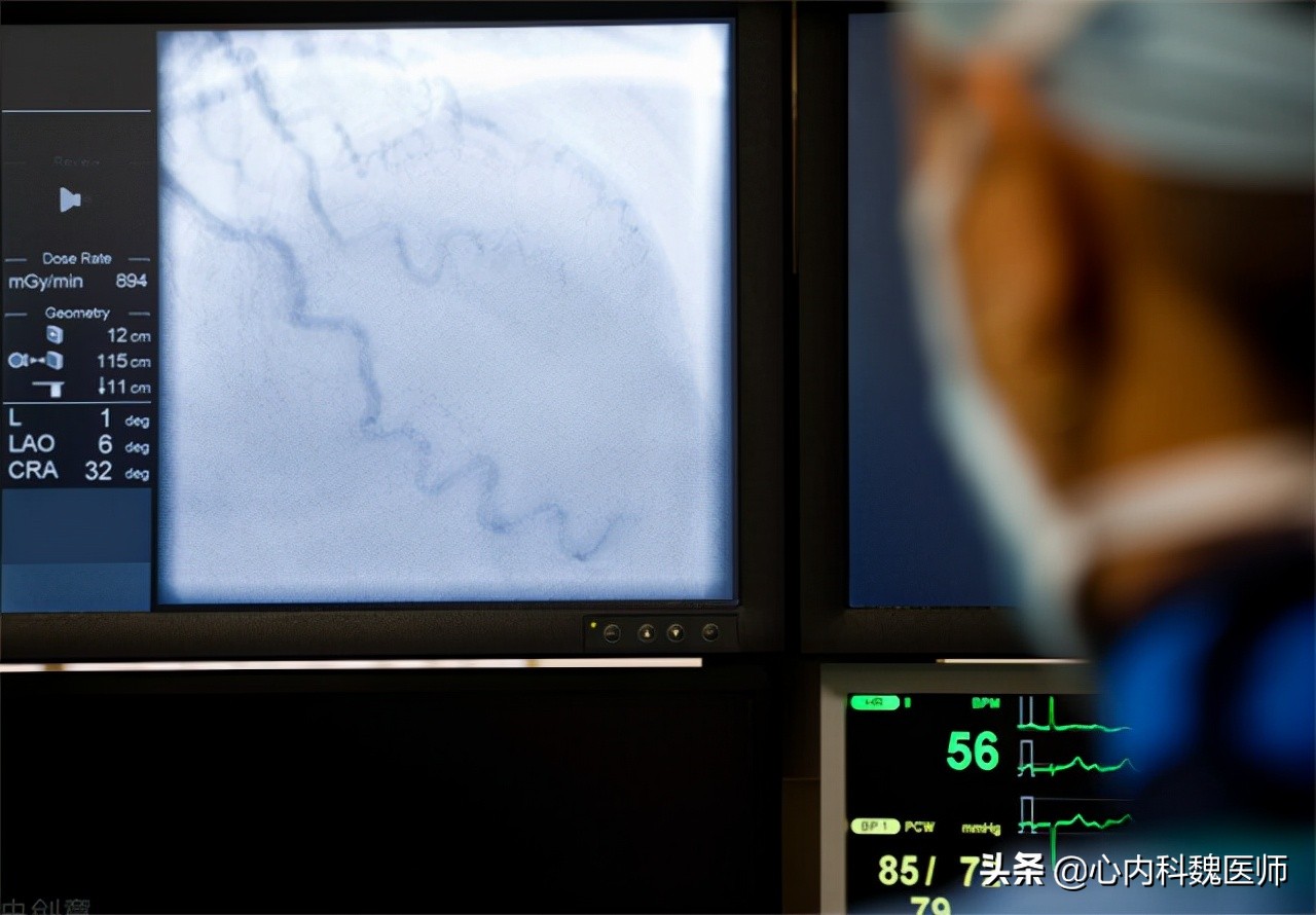 冠心病需要每年复查冠脉造影吗,冠脉造影能根治冠心病吗