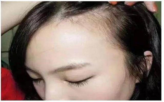 哪种额头不适合露出来,脸窄适合露额头