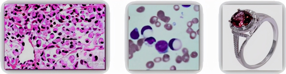 我不是药神,我不是财迷!若患胃癌,这些靶向药你有能力负担吗?