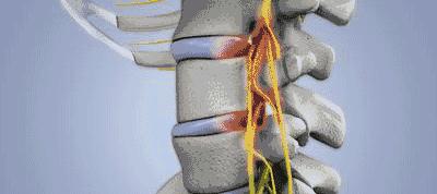 脖子疼枕高枕头舒服一点,打鼾者最舒服的枕头