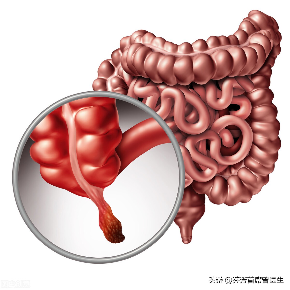 尿培养查出粪肠球菌感染反复发烧,尿液培养出粪肠球菌