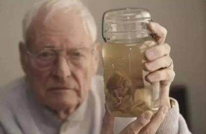 爱因斯坦大脑最后落到谁手上,爱因斯坦的大脑是不是最聪明的