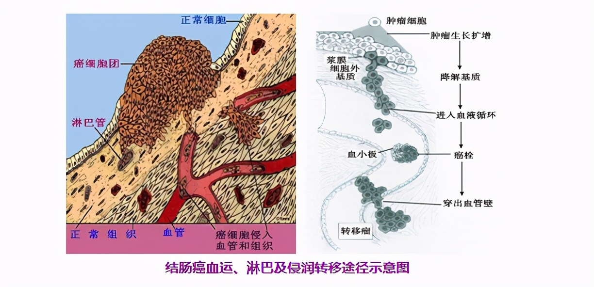 中药治疗放疗的药物有哪些,放疗和中药治疗哪个效果好