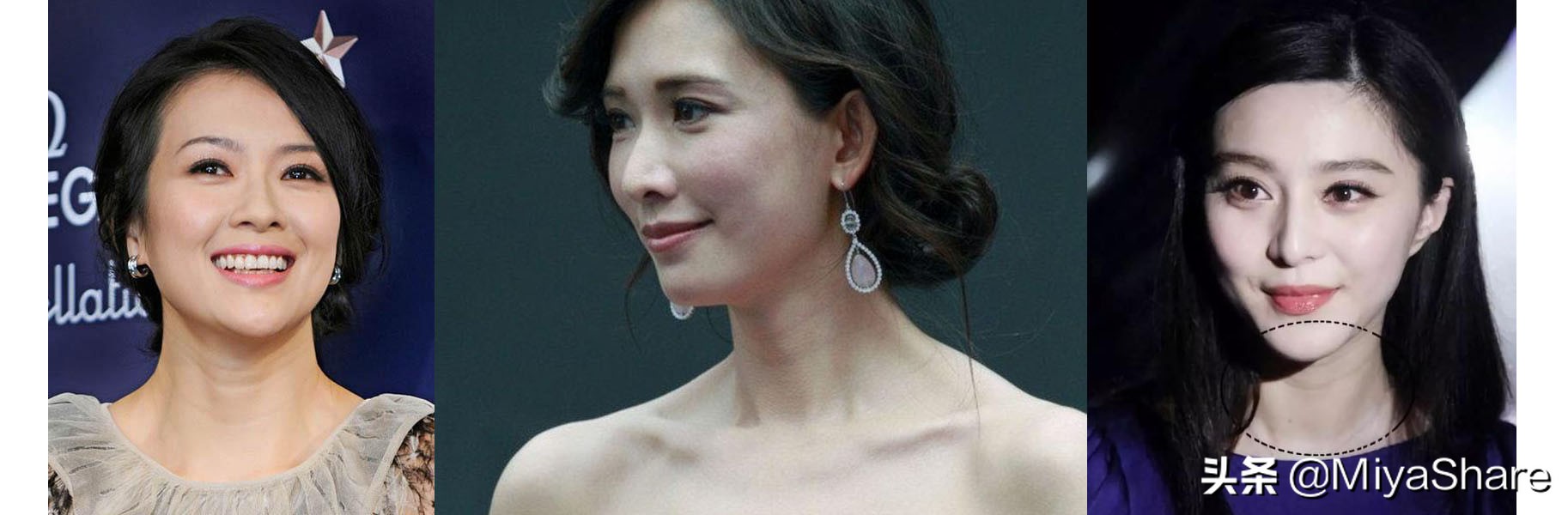 颈部有颈纹怎样祛颈纹,如何去除颈纹的最有效方法