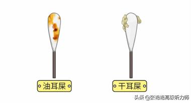 为什么有人耳朵流油,为什么耳朵老是油油的