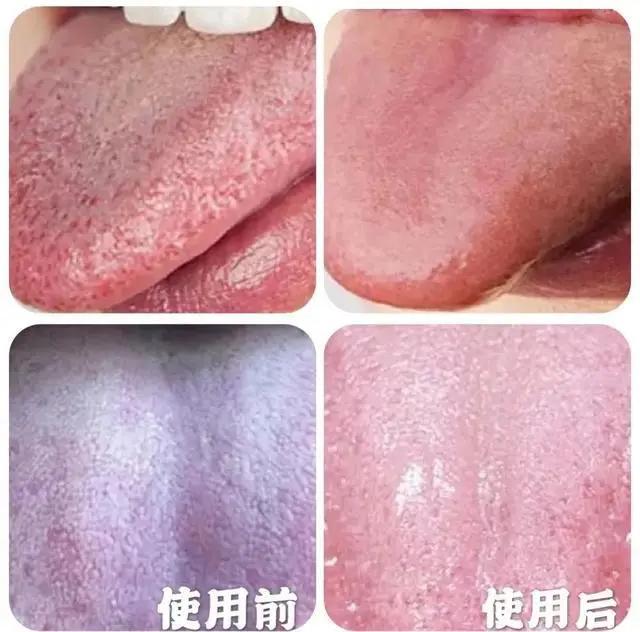 一张嘴就臭,一张嘴就口臭小妙招