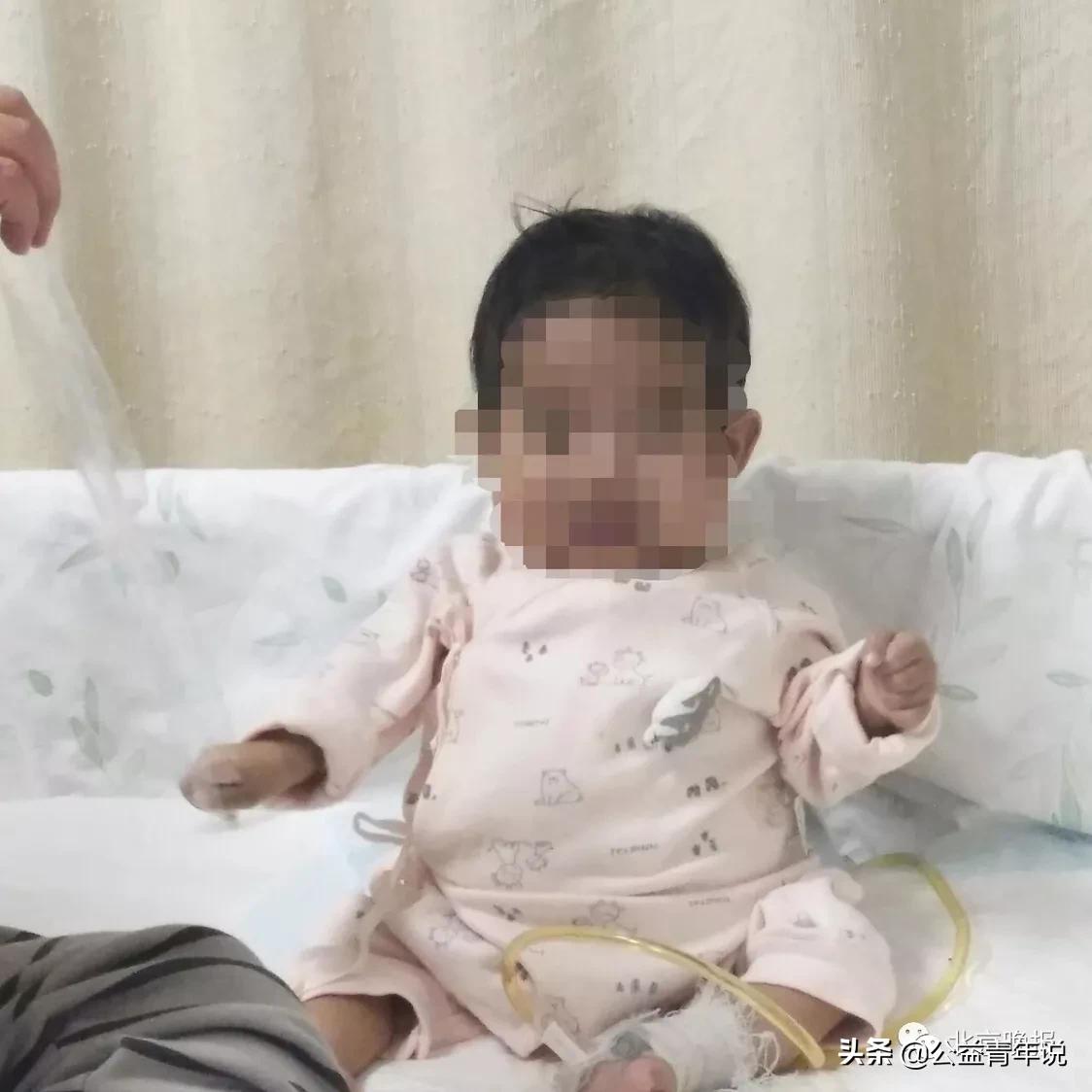 妈妈仨月疯狂减重220斤割肝救女,29岁父亲1个月减重18斤割肝救女