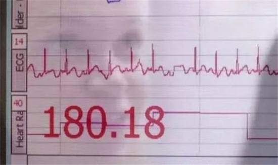 孩子发脾气这三个动作比吼更有用,孩子乱发脾气满地打滚怎么处理