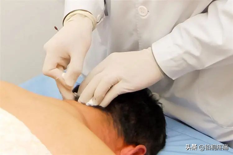 治疗疼痛用的针刀有哪些种,疼痛科小针刀治疗有副作用吗