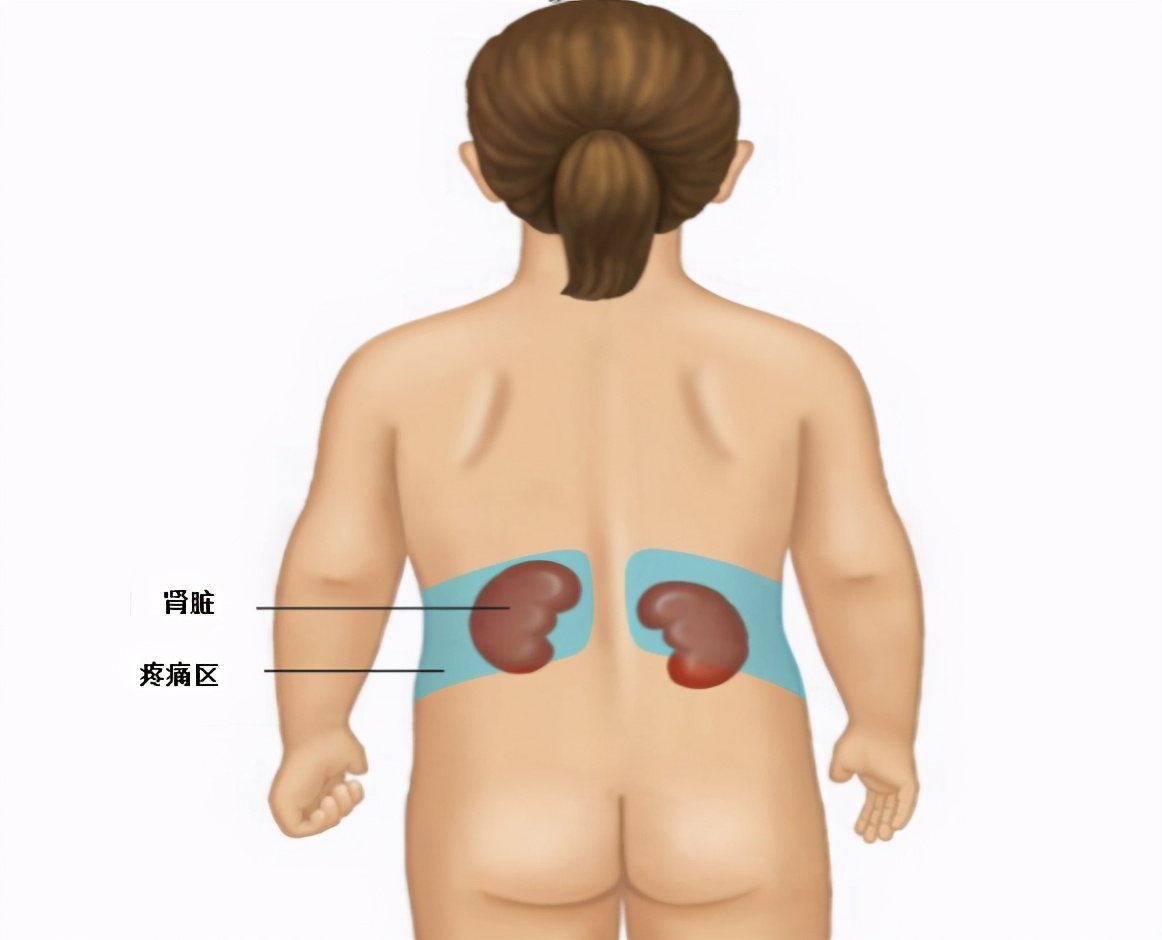 儿童尿路感染最主要的原因是,儿童尿路感染是什么引起的