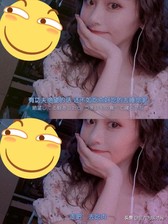 龅牙矫正成功的图片对比,2周岁龅牙可以矫正吗