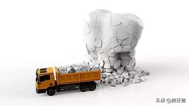 牙震荡怎么消除,牙震荡怎么办