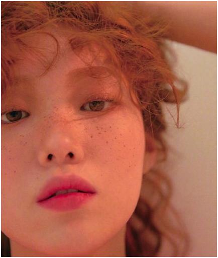 麻子草莓雀斑脸，欧阳娜娜祖儿示范小麻子如何从时尚毒药变新宠？