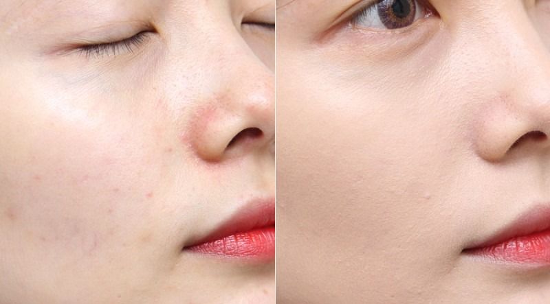 亦博气垫色号完美遮瑕,亦博气垫bb色号