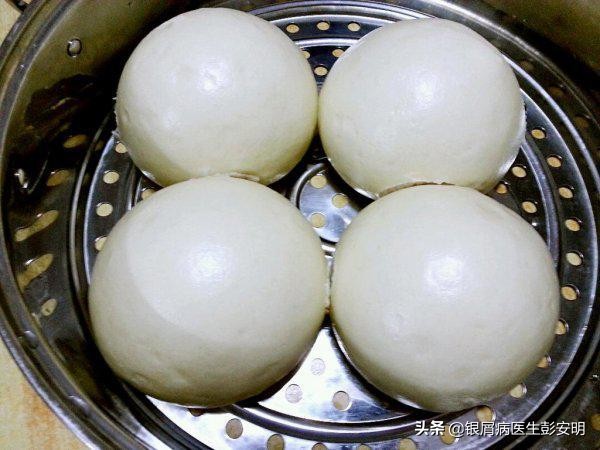 40多岁得了银屑病,40岁男性银屑病