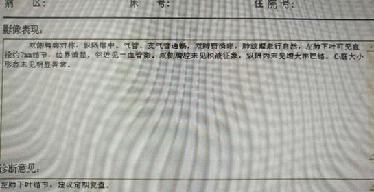 50岁女肺部8毫米结节治疗过程,女士肺结节康复