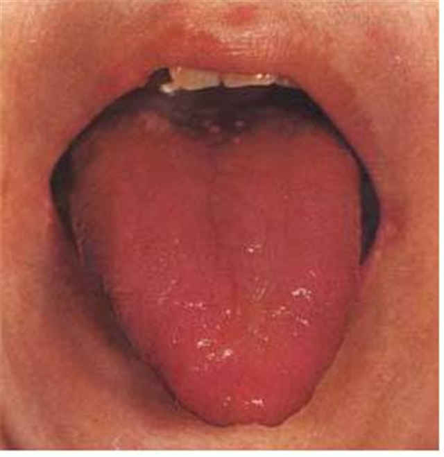 望舌知病实操完整版,教你看舌辨病