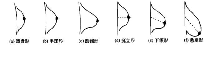 哺乳后胸部下垂怎么办,怎么预防胸部下垂