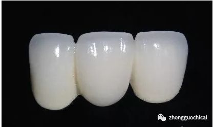 牙齿掉了镶哪种假牙比较好,牙齿缺失多用什么义齿好