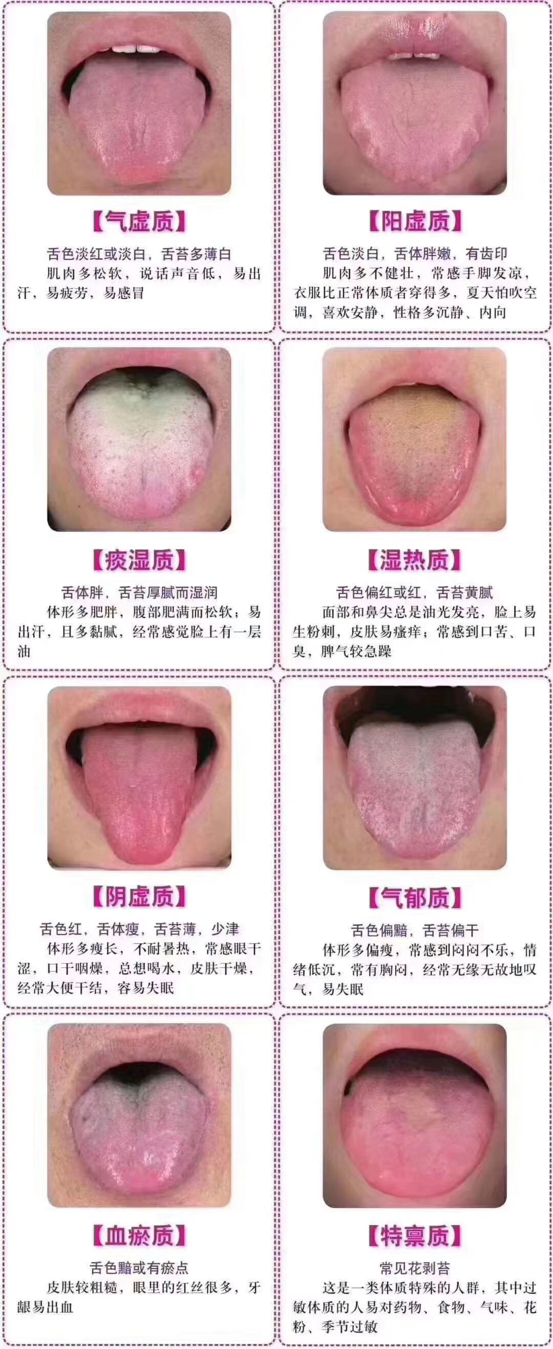 如何看舌头辨别健康状态,健康的舌头和不健康的舌头