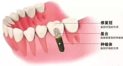 莆田系牙科坑人吗,莆田系口腔诊所曝光新闻