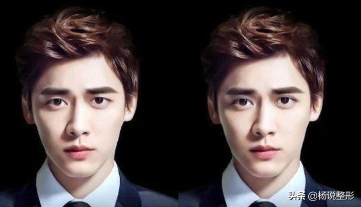 割双眼皮一定好看吗,割双眼皮真的好看吗