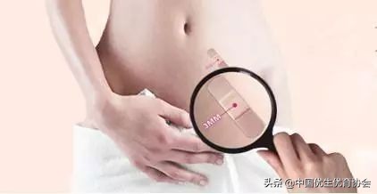 【听刘大夫说】宫腔镜手术后多久可以怀孕?