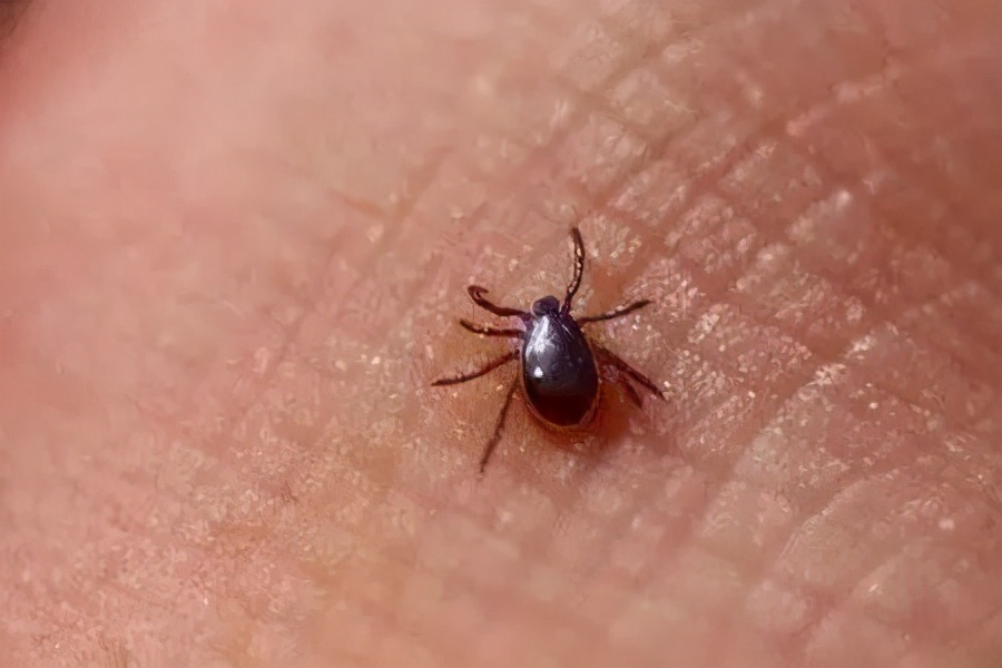 恙虫立克次体感染症状,恙虫病立克次体斑疹伤寒