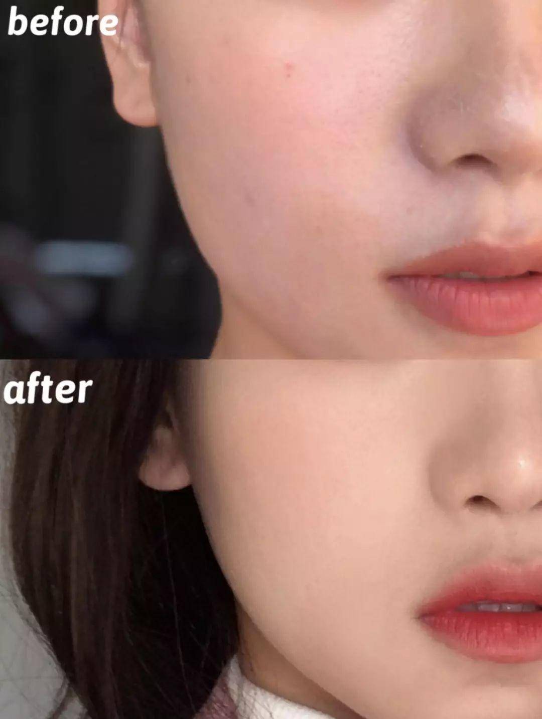 修复肌肤屏障期间脸轮廓干痒,修复肌肤屏障期间会痒吗