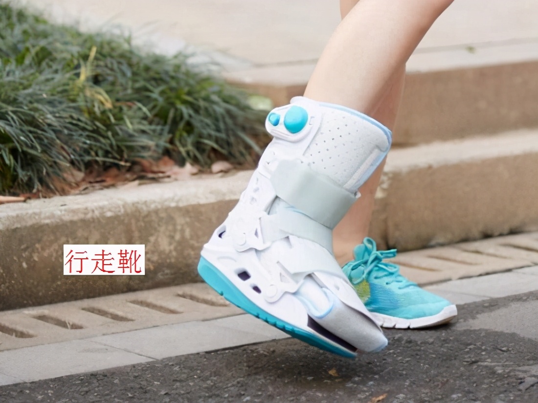 跟腱断裂后的非手术康复方案