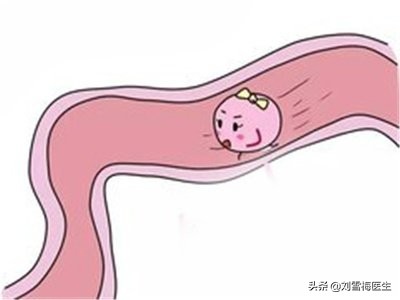 输卵管堵有必要切除吗,输卵管堵了做宫腔镜行吗