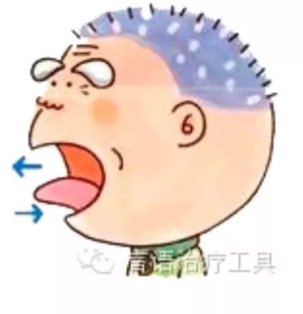 如何制定吞咽障碍康复治疗计划,言语吞咽障碍康复训练